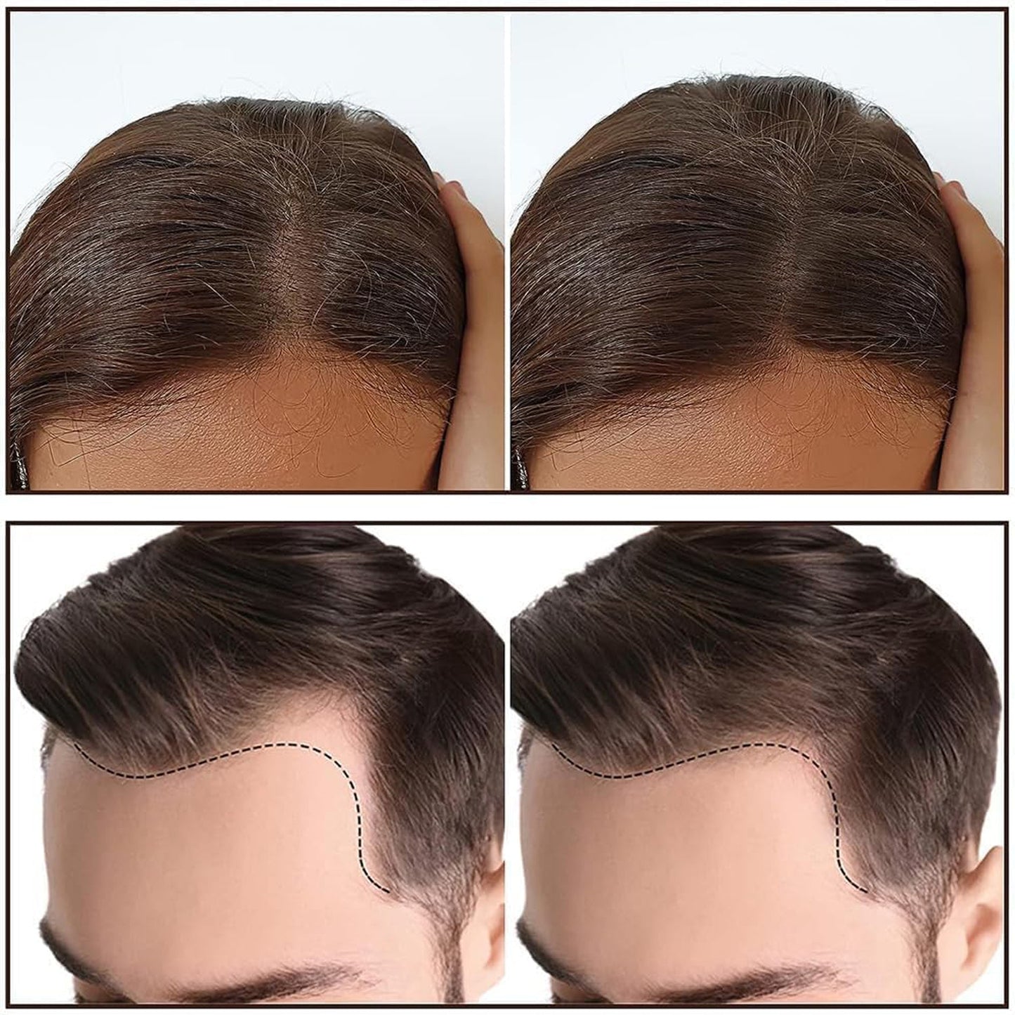 Hairline & Eyebrow Shaping - (Set)